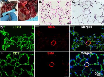 From 2D to 3D: Promising Advances in Imaging Lung Structure